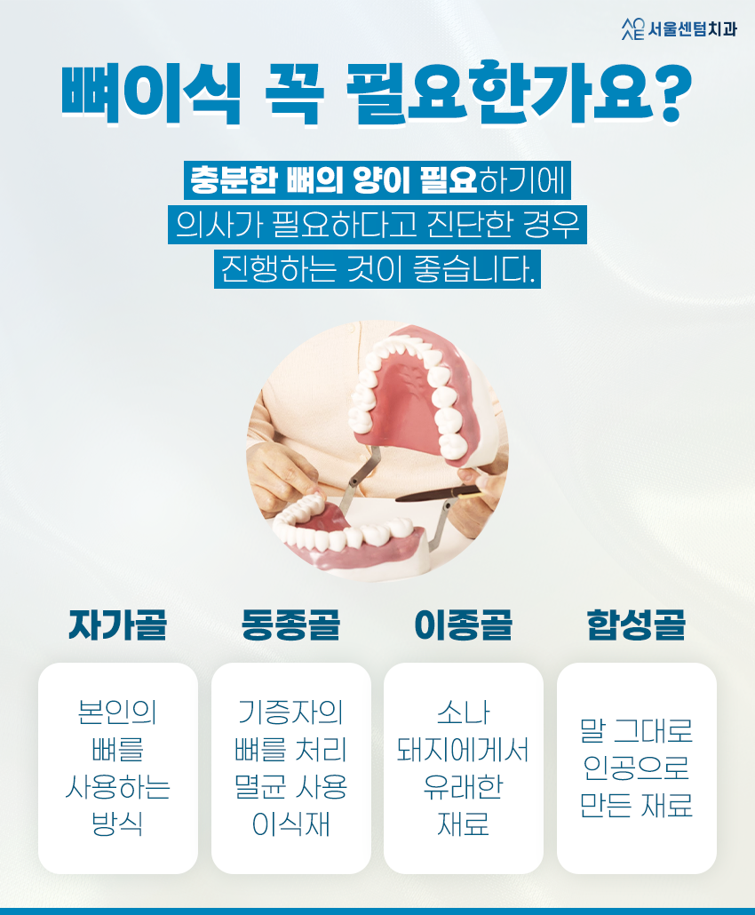 네오임플란트 뼈이식 꼭 해야할까?종류 장점 단점 관련 이미지 3