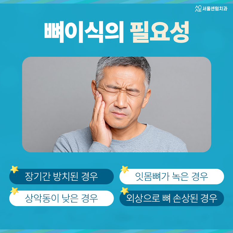 임플란트뼈이식통증 과정 필요성 관련 이미지 3