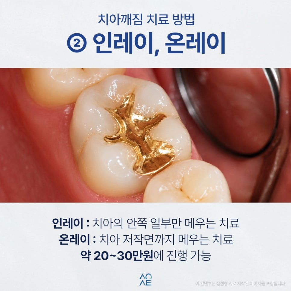 Is tooth chipping caused by cavities? I’m also wondering about the treatment cost. Will it be very expensive? image 5