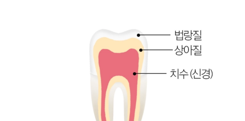 신사역 미백 치약? 전문가 미백? 차이가 분명하죠 관련 이미지 3