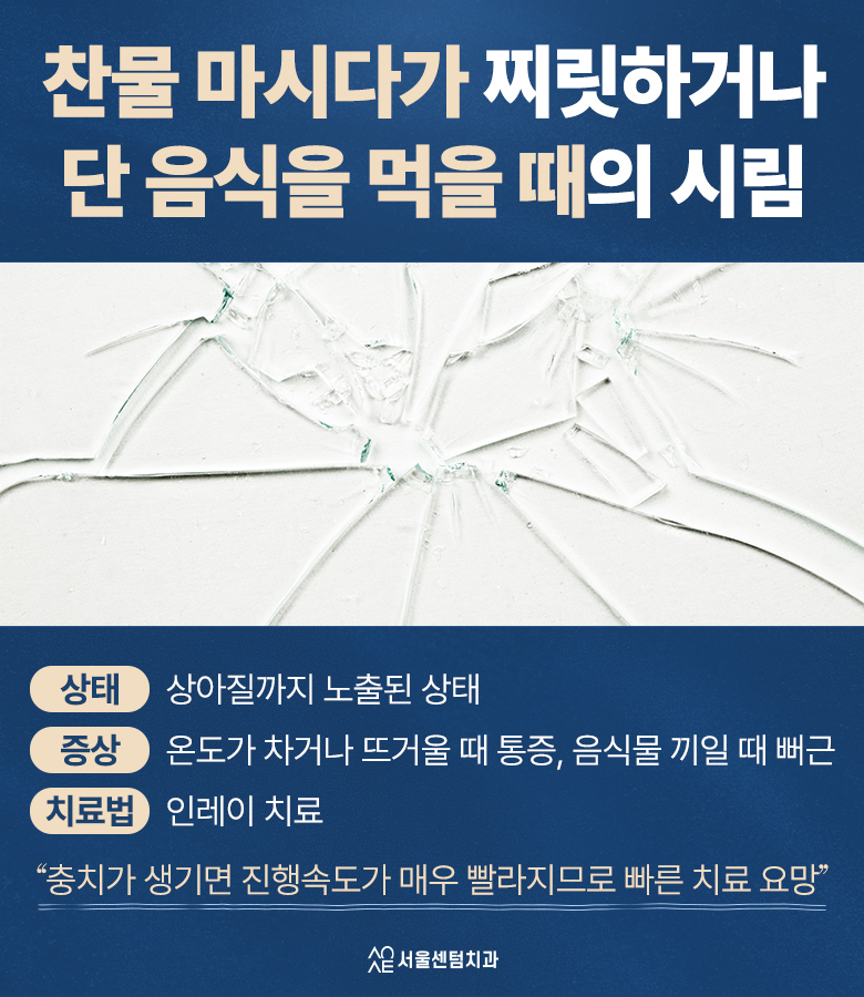 어금니 깨졌을 때 통증별 치료법 관련 이미지 3