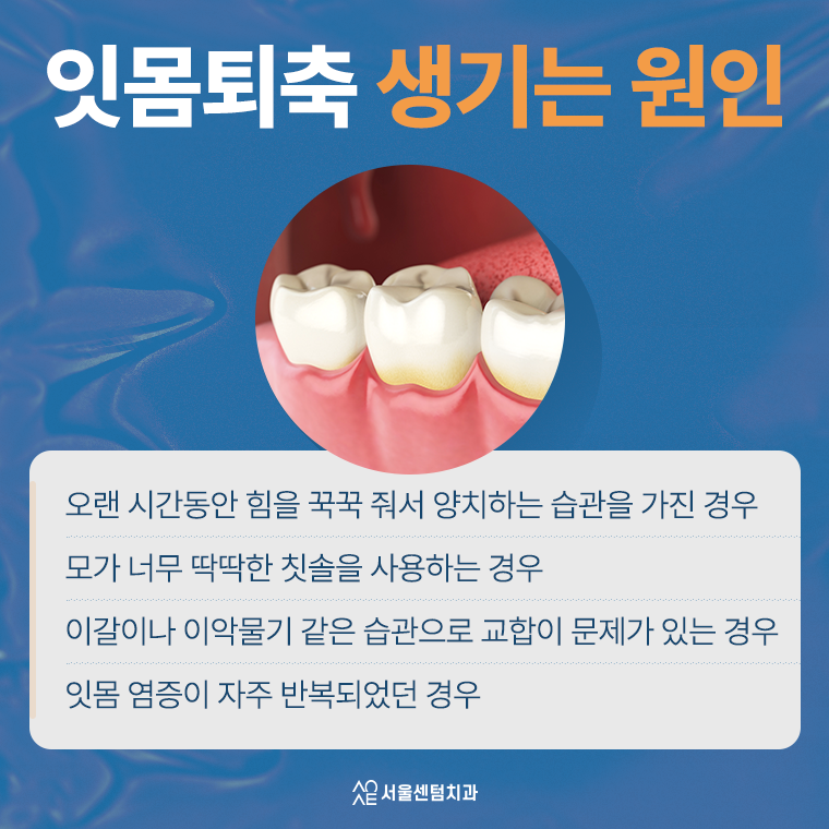 잇몸퇴축 레진치료 생각보다 간단하거든요 관련 이미지 2
