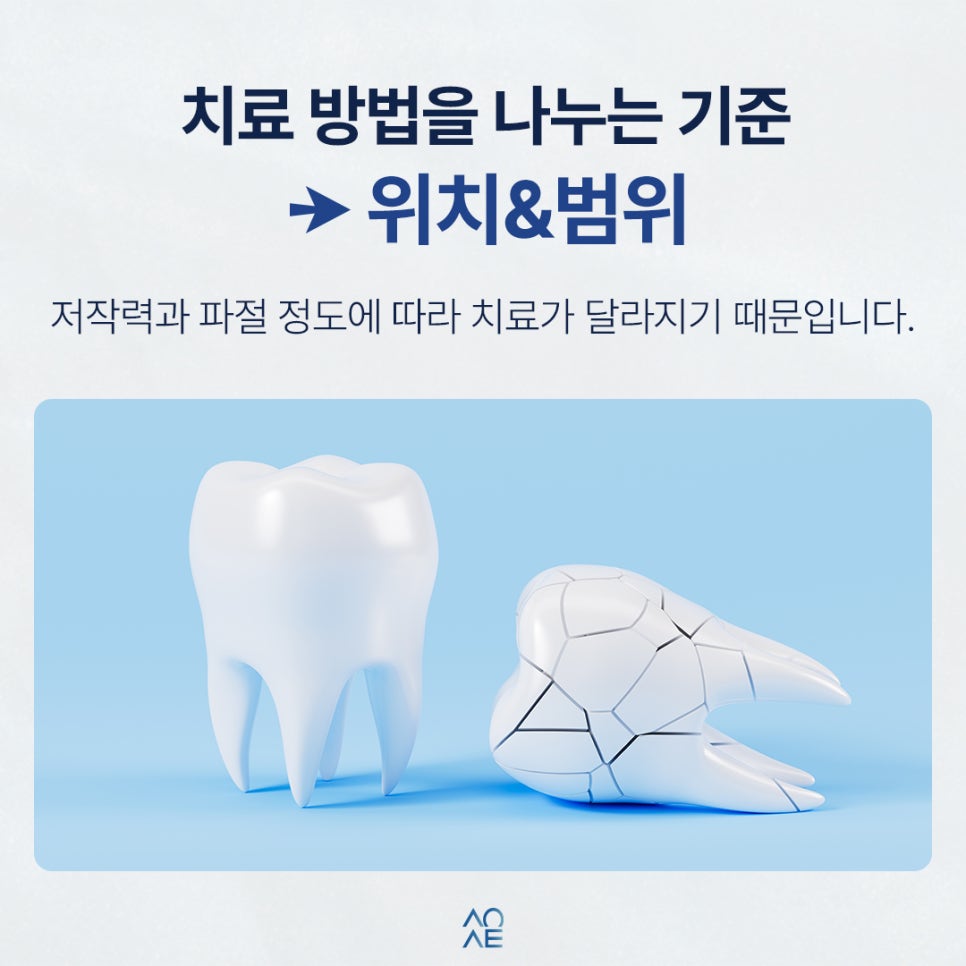 3 Treatment Options and a Cost Comparison for a Chipped Front Tooth image 2