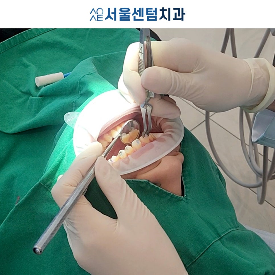 클리피씨 교정 이러한 경우라면 추천 관련 이미지 2