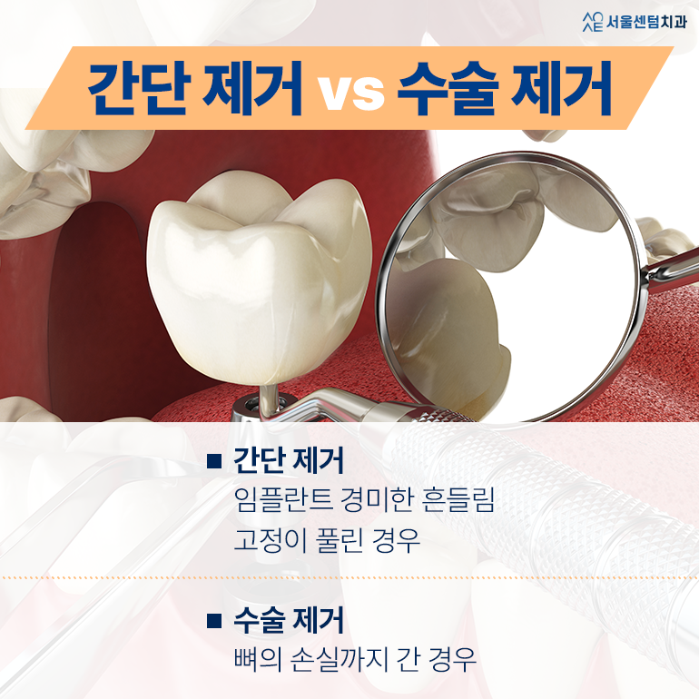Implant Removal: “I Paid This Much for It—Why Does It Have to Be Removed?” image 5