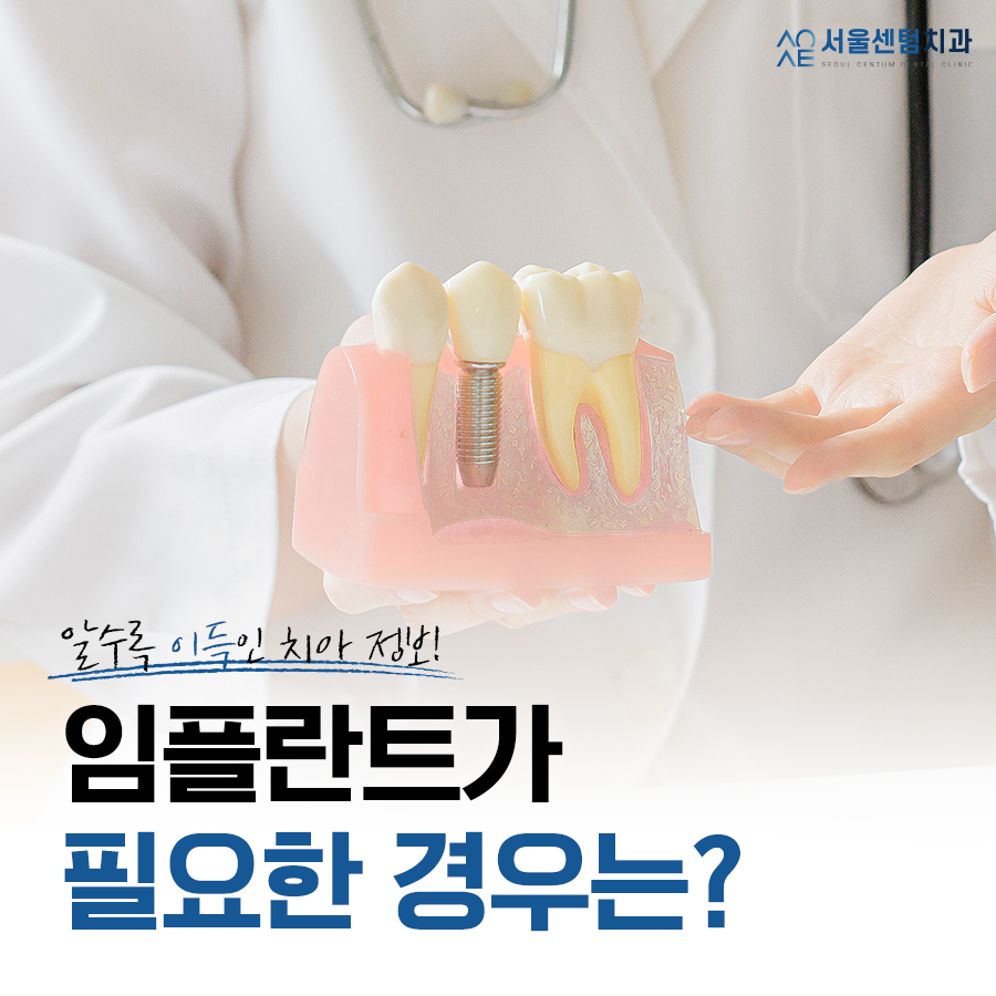 임플란트 뼈이식이 필요한 경우 구체적으로 확인하고 싶다면 관련 이미지 4