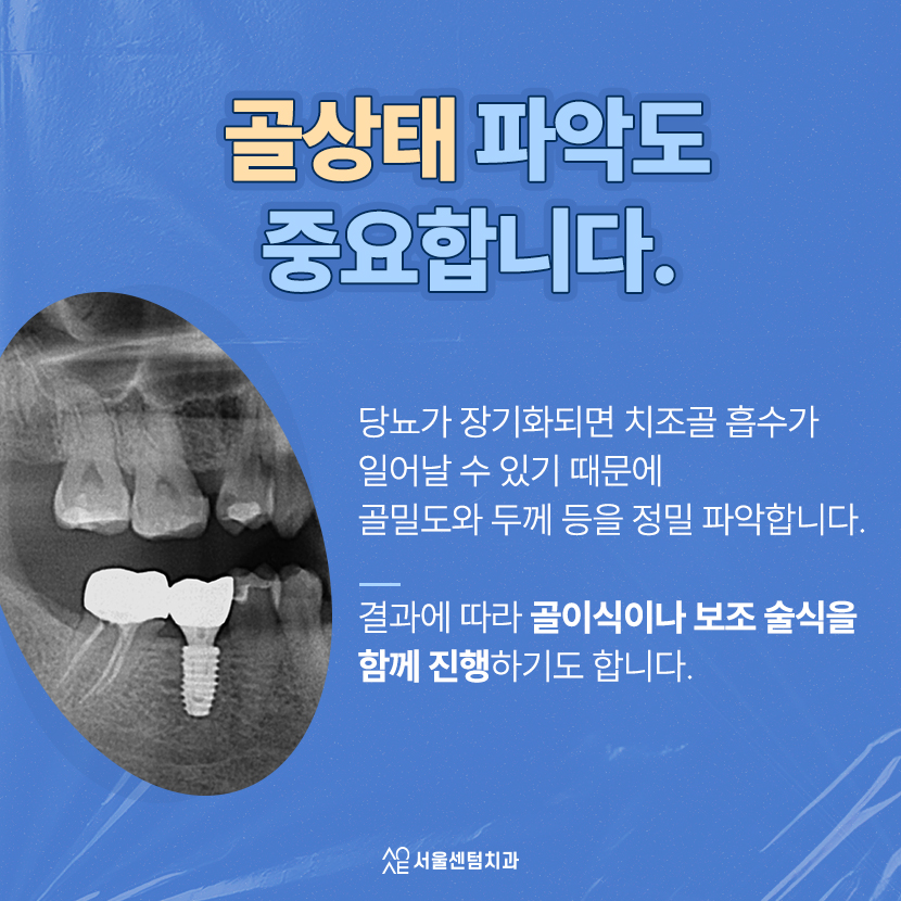 당뇨임플란트 가능 여부 관련 고찰 고혈압 동반 환자는 어떻게 관련 이미지 4