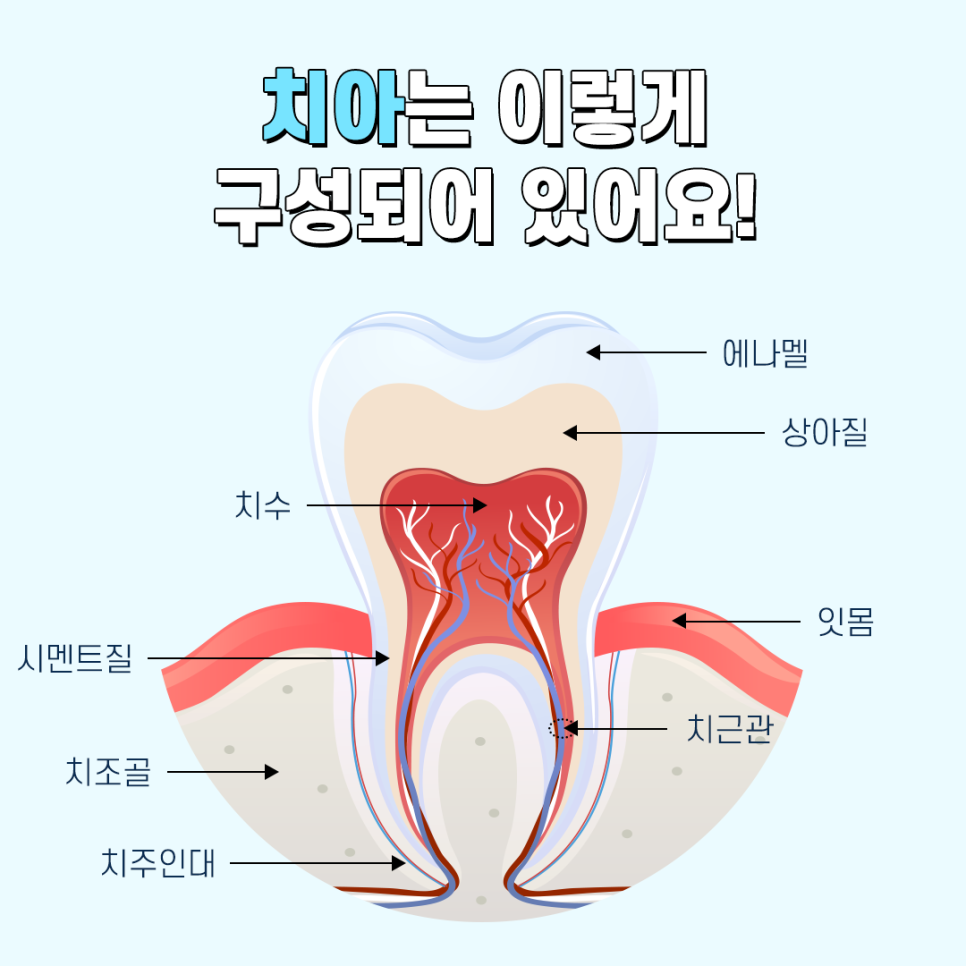 충치치료 나는 어떤 단계일까 관련 이미지 1