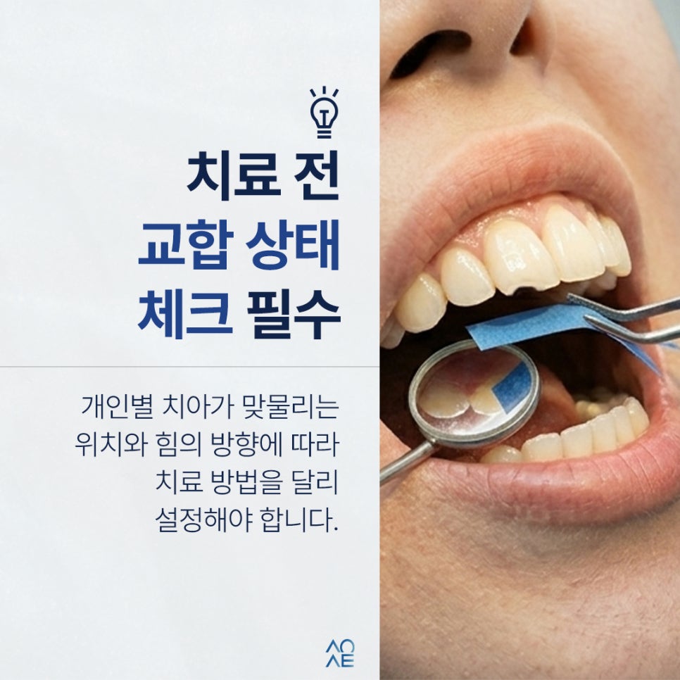 3 Treatment Options and a Cost Comparison for a Chipped Front Tooth image 7