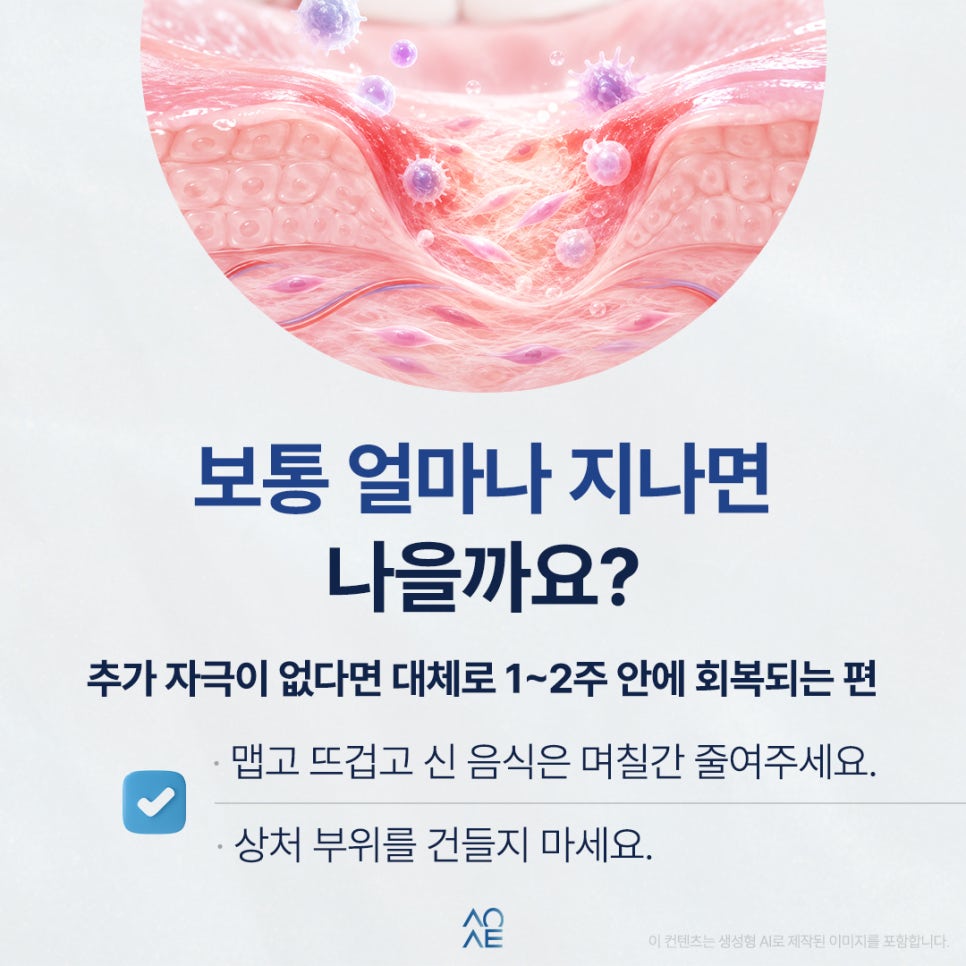 혓바닥 구내염 혀 세게 깨물었다가 생길 수 있는 건가요? 관련 이미지 4
