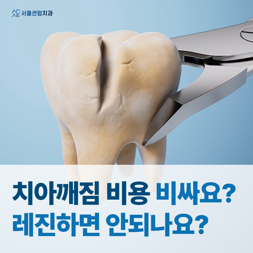 치아깨짐 비용 많이 나와 어금니 레진 고려한다면 알아두어야 할 것 관련 이미지 1