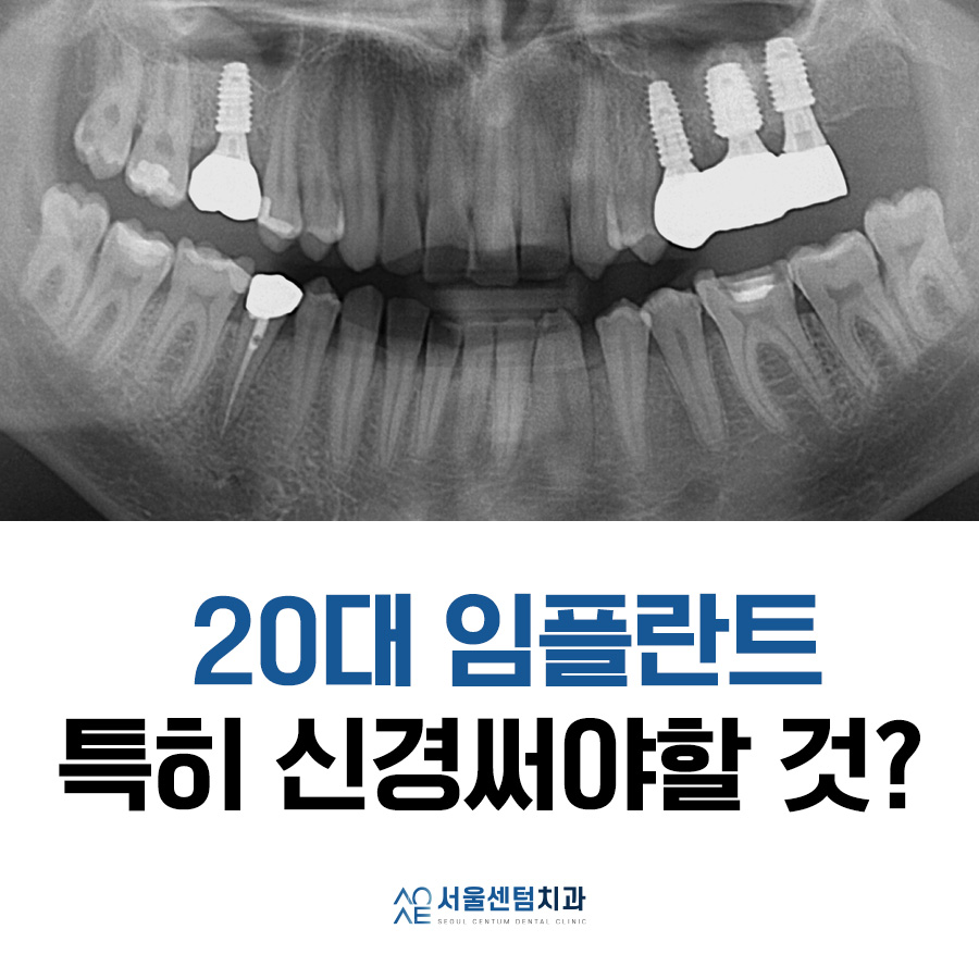 20대임플란트후기 진행과정부터 상세히 관련 이미지 7