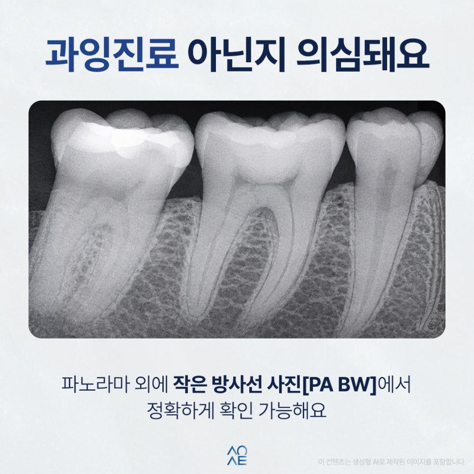 치과충치 진단 받았는데 진짜 치료 필요한거 맞을까요? 신경치료도 무섭고요 관련 이미지 2