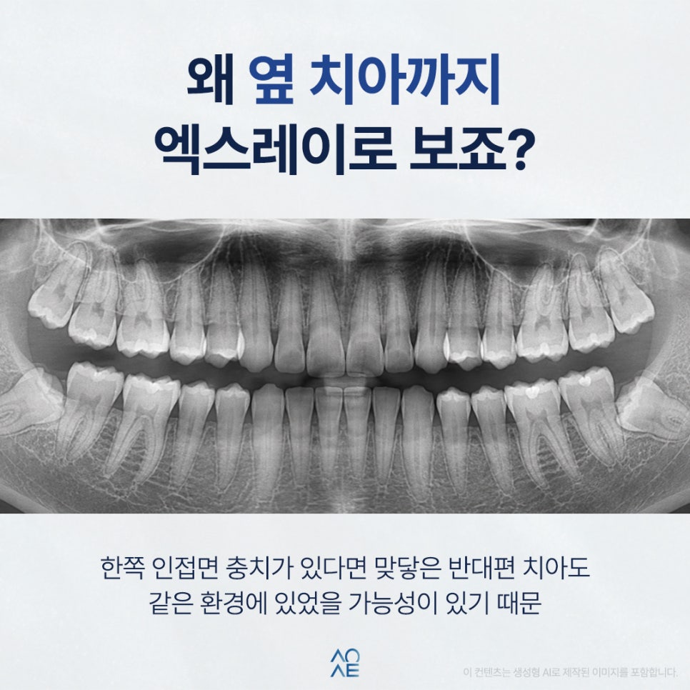 치아 사이 충치 옆까지 옮겨질 수 있나요? 관련 이미지 5