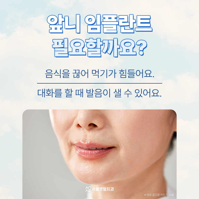 앞니임플란트 후기 찾아보고 골라야 하는 이유 왜 중요할까 관련 이미지 3
