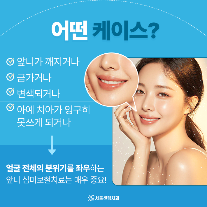 전치부 앞니 심미보철치료 중요한 이유 기능보다 먼저 보이는 치아이기 때문 관련 이미지 3