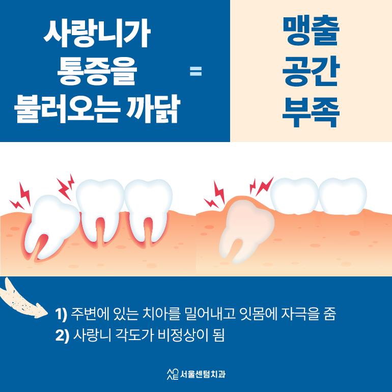 사랑니 날 때 통증 문제가 생겼다는 신호? 발치 필요 여부 체크 관련 이미지 2