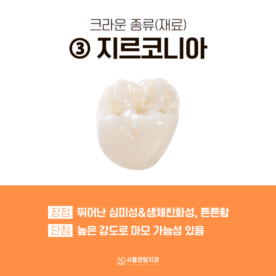 치과 크라운 종류 선택 쉽도록 설명할게요 관련 이미지 5