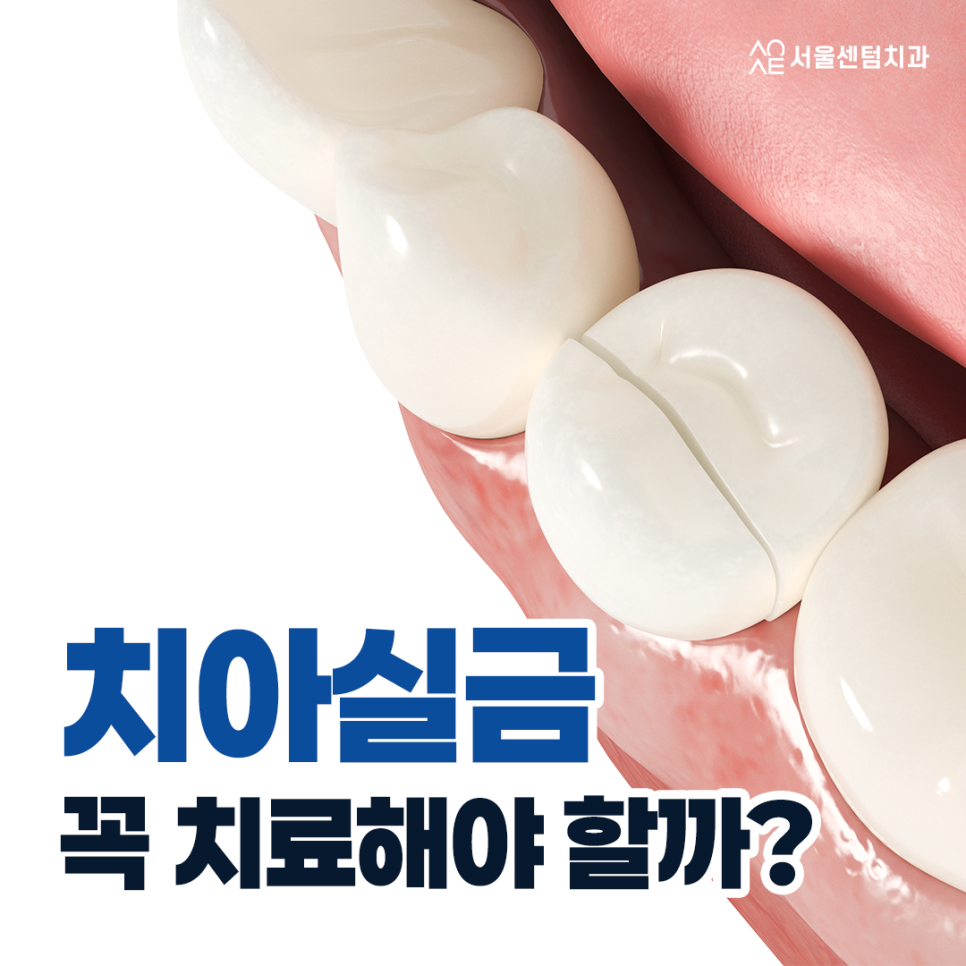 치아실금 신경쓰인다면 이것 체크하세요 관련 이미지 1