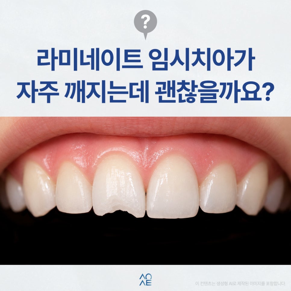 Can Laminate Veneers’ Temporary Teeth Break Frequently? Do I Need to Visit the Dentist Every Time? image 1