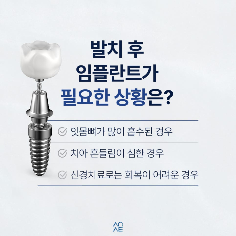 임플란트 치주염 옆자리에 권유받았다면 필요한지 판단할 것 관련 이미지 5