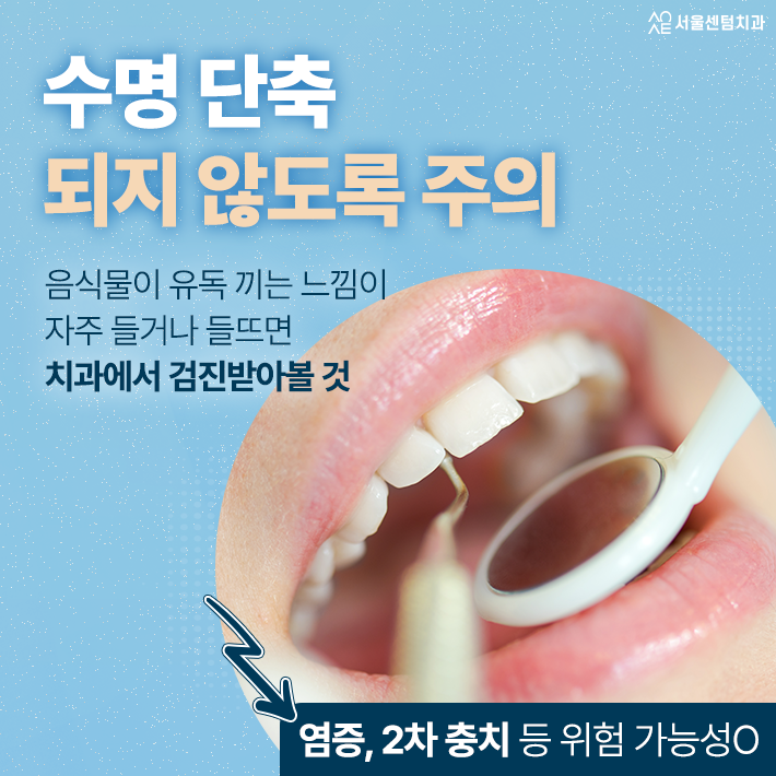 신경치료 시 크라운 수명이 달라지는 원인은 종류 때문일까 관련 이미지 5