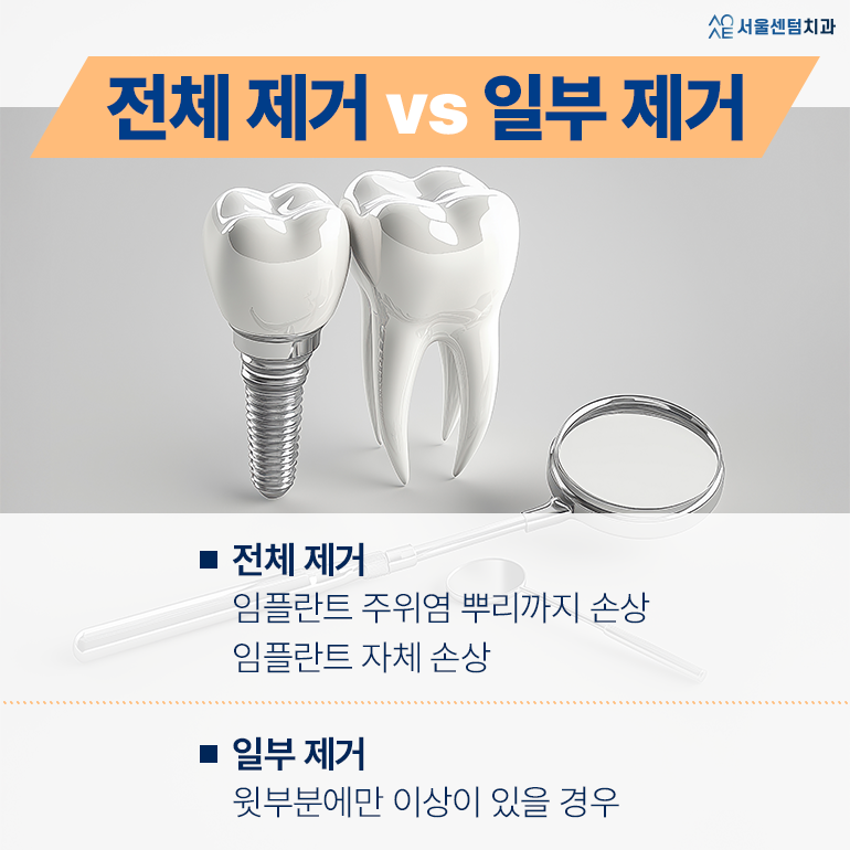 Implant Removal: “I Paid This Much for It—Why Does It Have to Be Removed?” image 4
