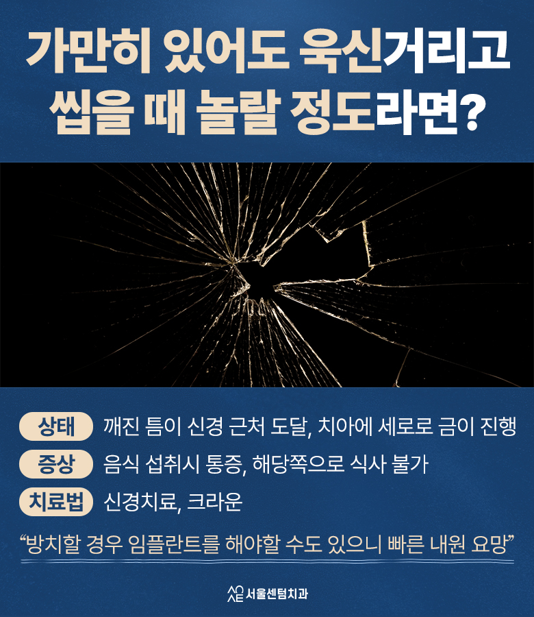 어금니 깨졌을 때 통증별 치료법 관련 이미지 4