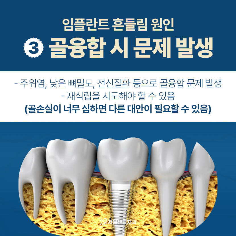 Why You Must Not Ignore a Loose Dental Implant image 4