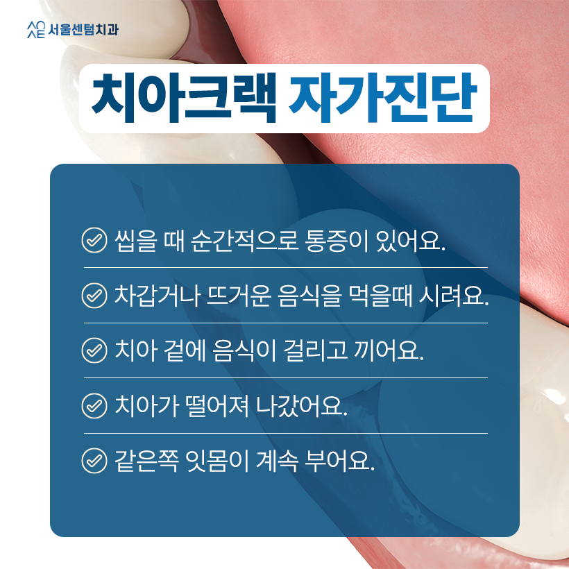 치아깨짐 비용 많이 나와 어금니 레진 고려한다면 알아두어야 할 것 관련 이미지 2