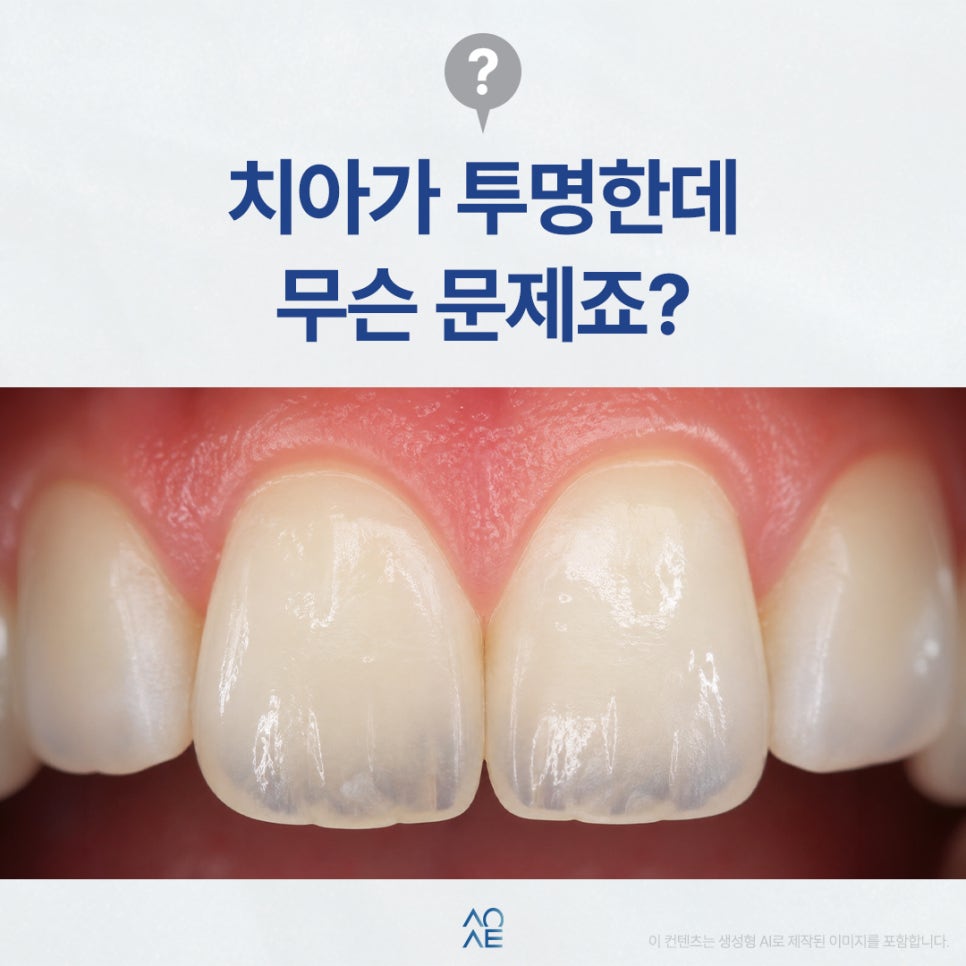 My Teeth Look Transparent in the Mirror—Is There a Problem? Are They Ruined? image 1