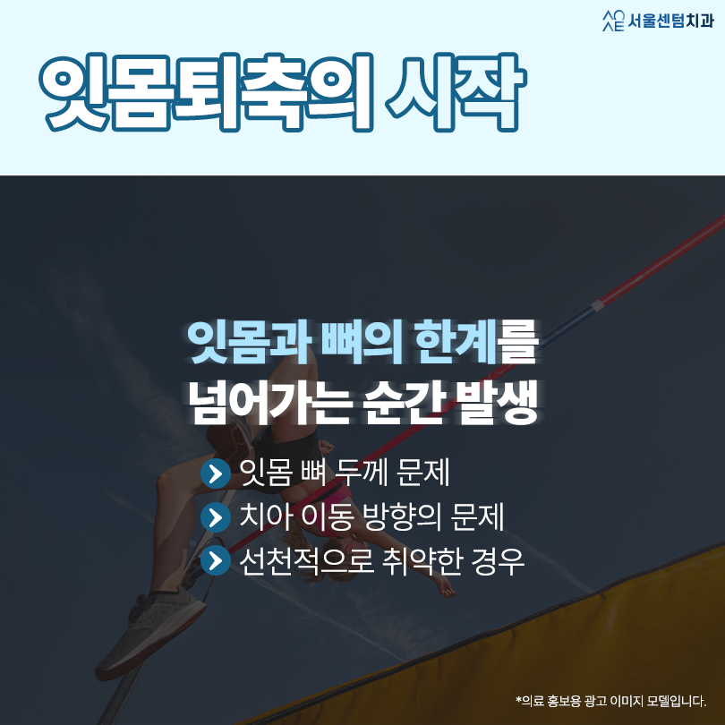 치아교정 잇몸 퇴축 왜 발생하고 어떻게 막을 수 있을까 관련 이미지 2