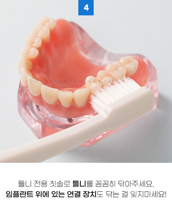 틀니임플란트 주의사항 알면 장점을 더 누릴 수 있어요 관련 이미지 8