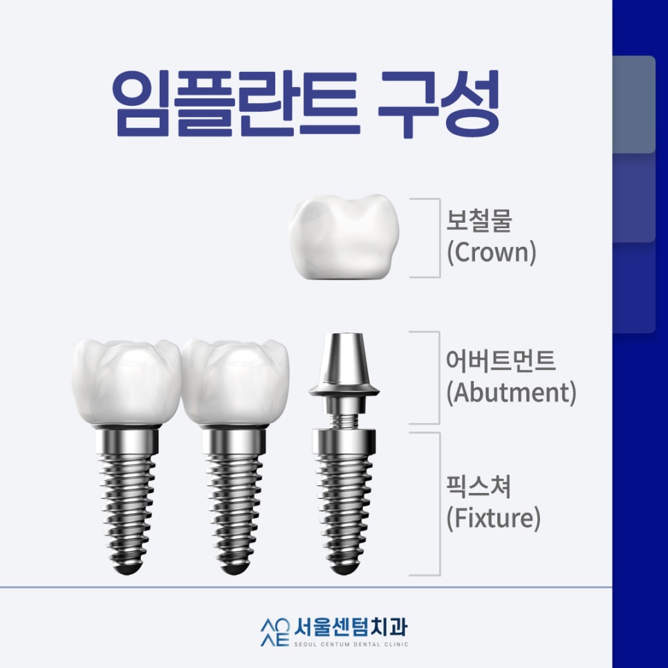 임플란트 시술과정 총 몇번 치과에 가야할까? 관련 이미지 1