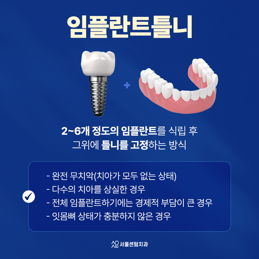 임플란트 틀니 가격 치과마다 다른 진짜 이유가 있다? 관련 이미지 2