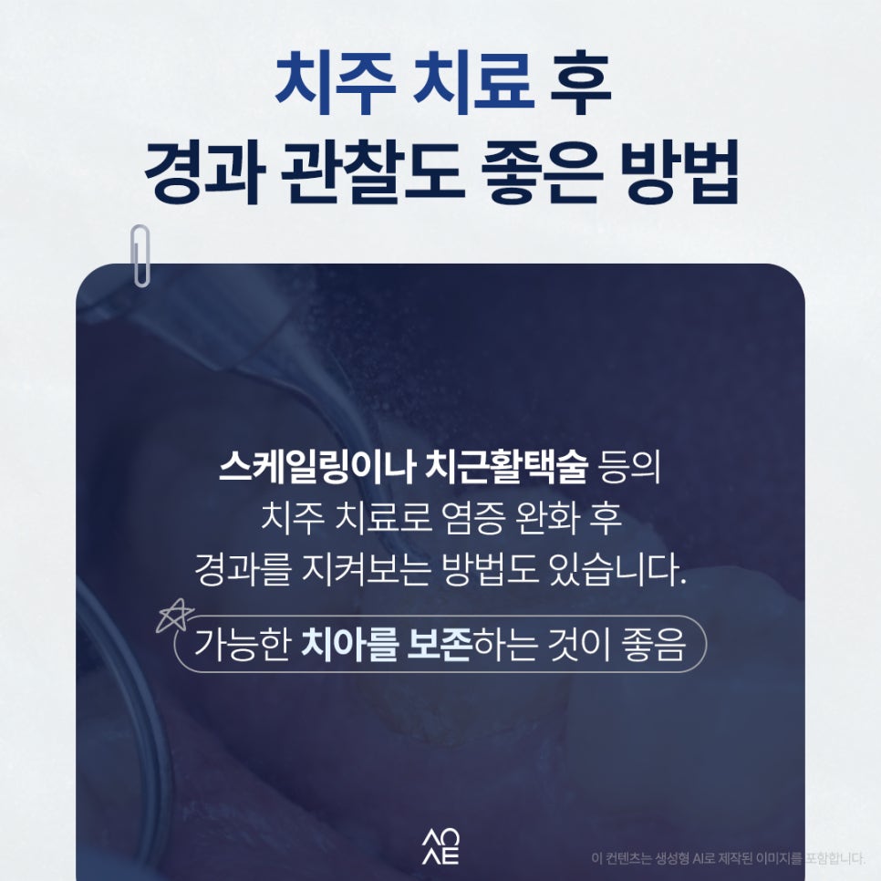 임플란트 치주염 옆자리에 권유받았다면 필요한지 판단할 것 관련 이미지 4