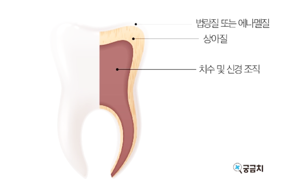 치과 앞니 사이 레진, 당일 진료 가능 관련 이미지 4