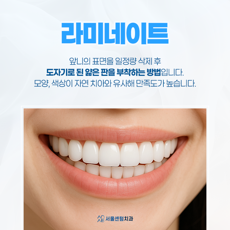 라미네이트 치과 이런 점을 보고 결정하셔야 합니다. 관련 이미지 3