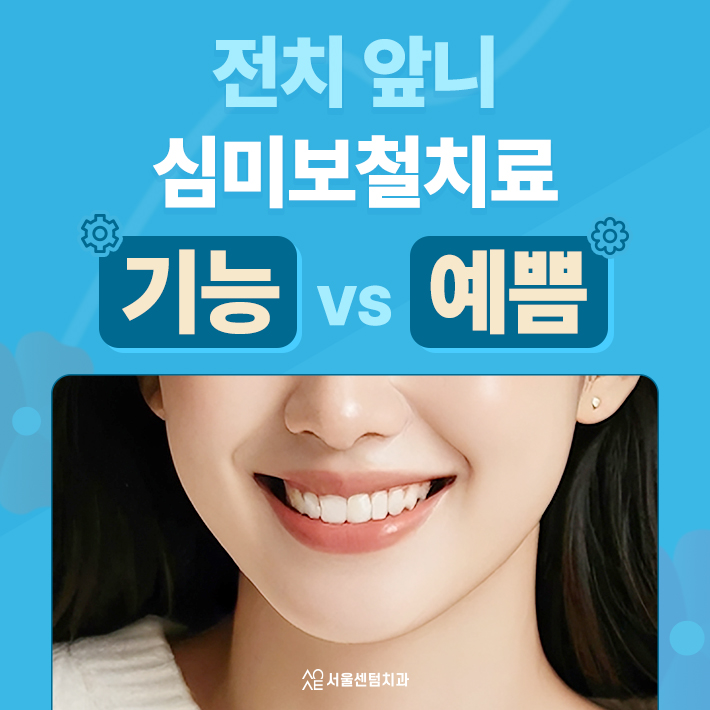전치부 앞니 심미보철치료 중요한 이유 기능보다 먼저 보이는 치아이기 때문 관련 이미지 1