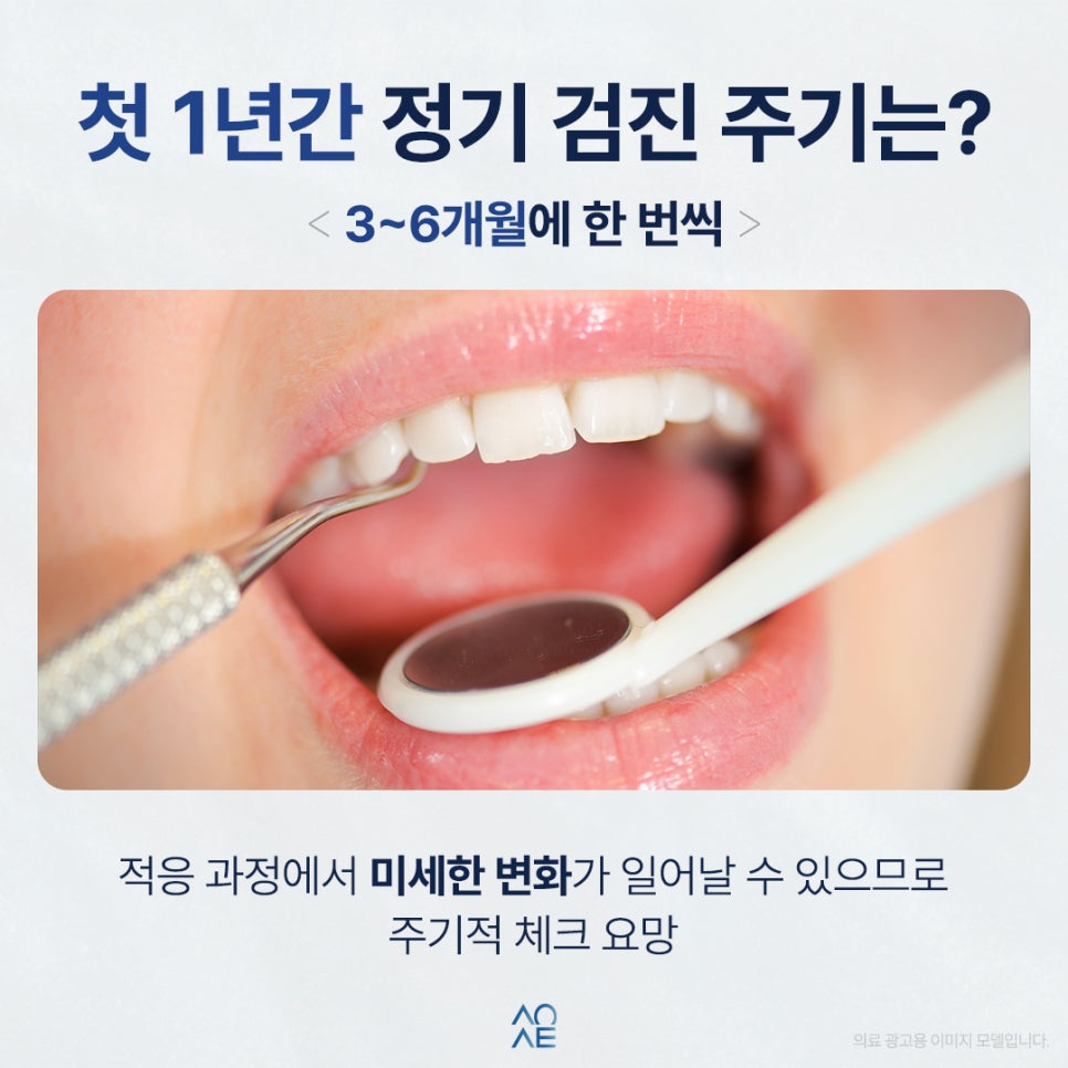 임플란트 정기검진 전체했는데 주기 궁금해요 1년에 몇 번 받아야 하나요 관련 이미지 2