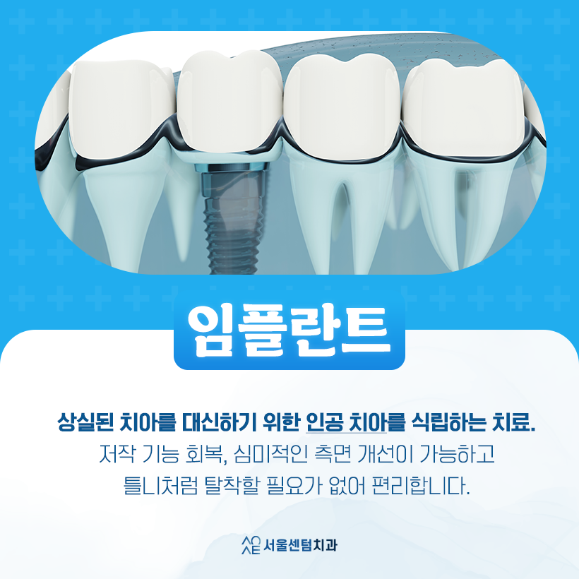 임플란트회사 (브랜드) 중요할까? 관련 이미지 4