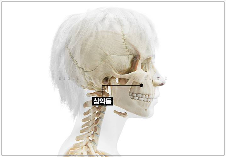 임플란트 뼈이식이 필요한 경우 구체적으로 확인하고 싶다면 관련 이미지 8