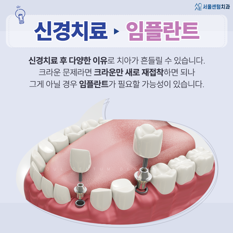 흔들리는 치아 가만히 두지 말고 즉각 치료받아야 하는 경우는? 관련 이미지 5