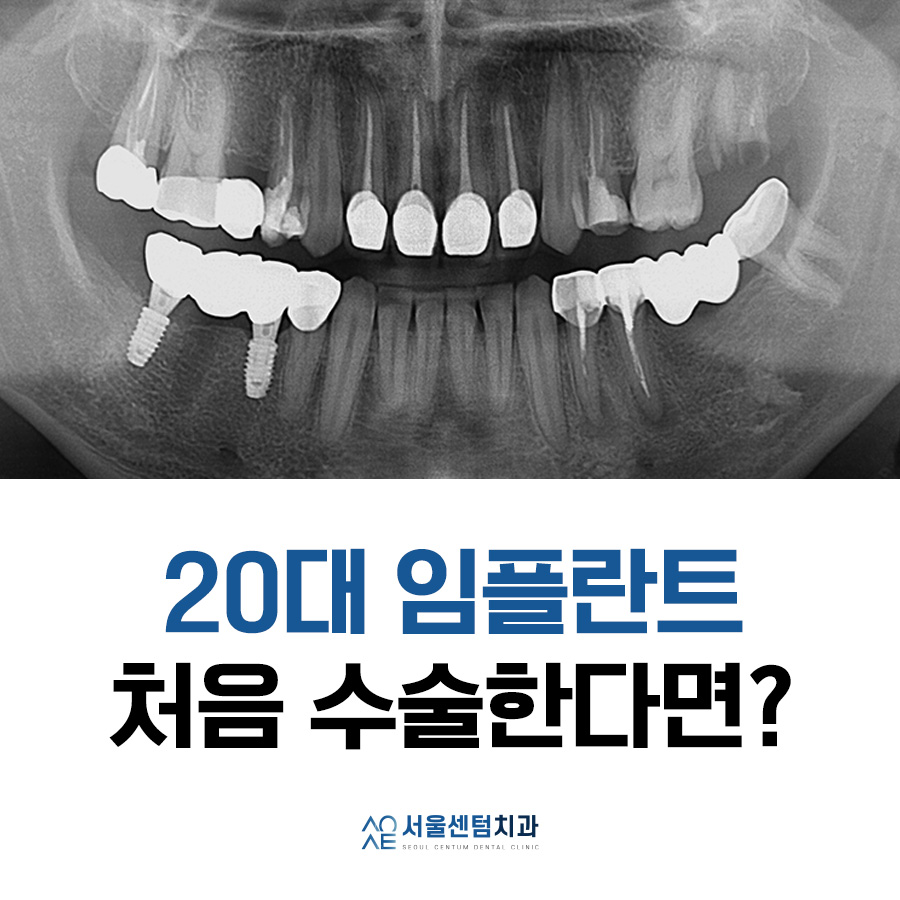20대임플란트 처음이라 두렵다면 관련 이미지 7