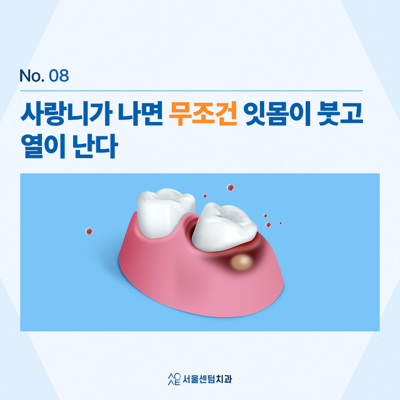 사랑니 발치 후 관련 이미지 6