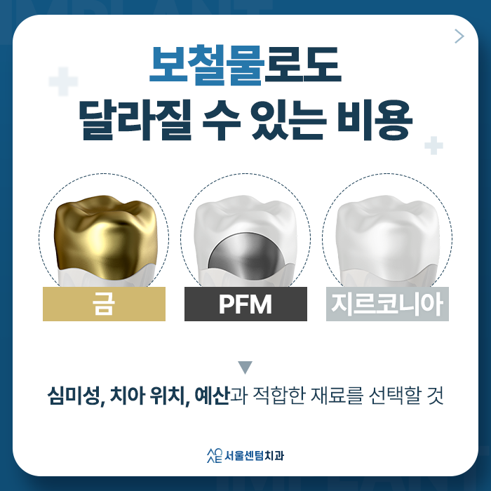 전체임플란트 비용 기준 삼는 사항을 바탕으로 결정된다? 관련 이미지 4