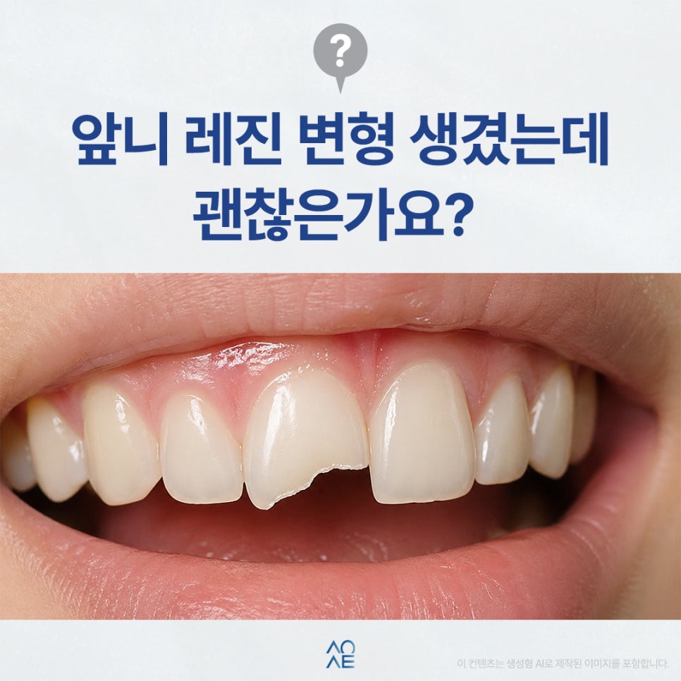 Why Does the Front Tooth Resin Develop a Bend? A Summary Including Whether Re-treatment Is Needed and the Possibility of Root Canal Treatment image 1