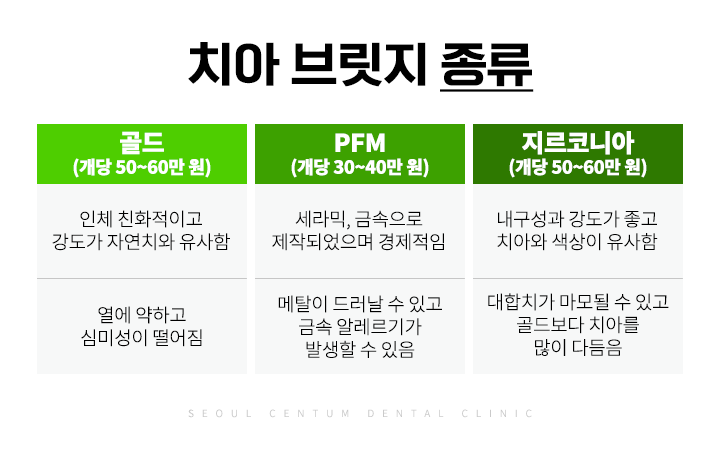 치아브릿지가격 종류에 따른 안내와 장단점 설명 관련 이미지 5