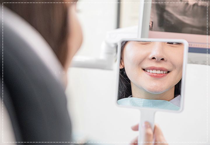 치아브릿지가격 종류에 따른 안내와 장단점 설명 관련 이미지 3