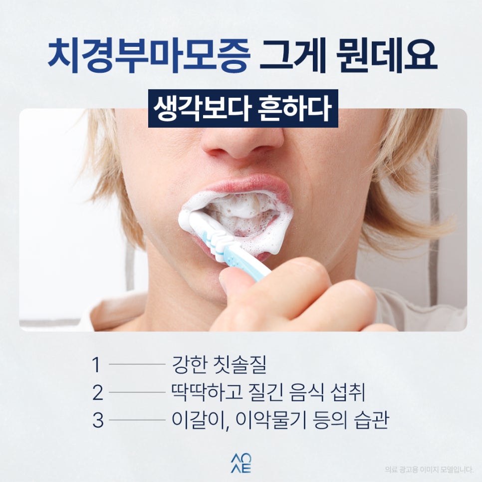 치경부마모증 하나당 얼마일까요 싼걸로 추천해주세요 관련 이미지 2